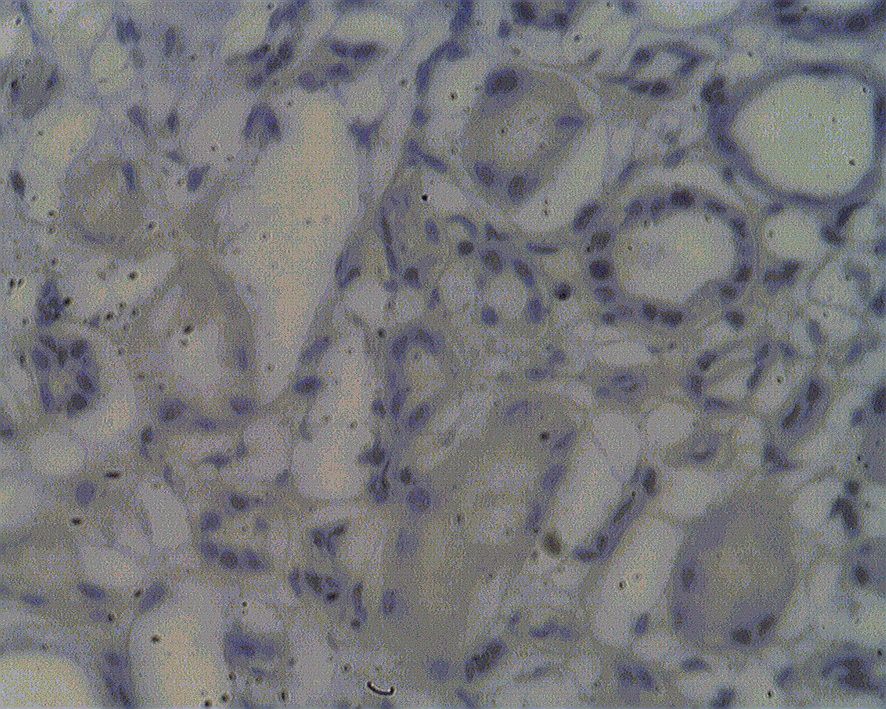 Staining on paraffin embedded normal human kidney sections using NOL4 antibody (Cat. No. X2728P) at 2 µg/ml.  Antigen retrieval used: 10 mM Na Citrate pH 6.0, 10 minutes pressure cooker method, developed with anti rabbit HRP and DAP substrate. Counterstained with methyl blue.